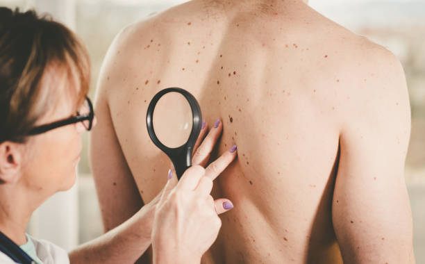 Skin Cancer Screening Saves Lives: Why Regular Checks Matter More Than Most People Realize Skin Cancer